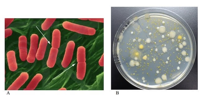 Scissione binaria di Escherichia coli